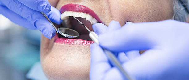 Best Emergency Broken Tooth Repair in Bozeman, MT